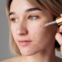 4 Serum yang Mengandung Kojic Acid Terbukti Ampuh Pudarkan Hiperpigmentasi