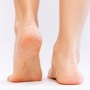 10 Rekomendasi Krim Kaki Terbaik (Foot Cream) untuk Kulit Kering dan Kapalan