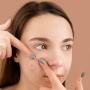 Jerawat Membandel! Ini Solusi Dermatologis yang Aman untuk Kulit Remaja