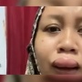 4 Fakta Viral Bibir Bengkak 3 Jam Sebelum Akad Nikah, Pengantin Wanita Asal Bekasi Kaget!