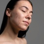 Flek Hitam di Wajah Makin Parah? Mungkin Kamu Melakukan 5 Kesalahan Skincare Ini