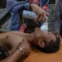 Demo Pati Ricuh, Gas Air Mata Kembali Makan Korban: Apa yang Harus Dilakukan Saat Terpapar?
