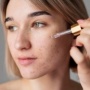 4 Serum Cysteamine Kaya Antioksidan, Bikin Wajah Cerah dan Atasi Dark Spot!