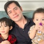 Anak Ricky Perdana Jatuh dari Lantai Dua, Kondisinya Memprihatinkan