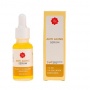 4 Serum Viva untuk Usia 40 Tahun ke Atas: Samarkan Kerutan, Garis Halus, dan Flek Hitam