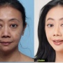 6 Potret Asri Welas Setelah 6 Bulan Oplas: Ini Keputusan Terbaikku!