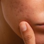 5 Moisturizer Alternatif Cerave untuk Atasi Skin Barrier Rusak, Kulit OTW Mulus Kembali
