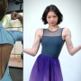 Nada Tarina Pamer Bekas Jahitan Operasi, Kenapa Skoliosis Lebih Rentan pada Wanita?