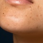 5 Rekomendasi Moisturizer Penghilang Chicken Skin, Kulit Halus Impian Jadi Kenyataan!