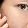 Vitamin Apa Untuk Menghilangkan Flek Hitam? Ini 5 Pilihan Skincare dengan Bahan Aktif Paling Aman
