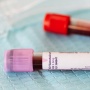 Mengenal Golden Blood: Golongan Darah Super Langka di Dunia, Cuma Dimiliki Puluhan Orang!