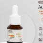 9 Serum Terbaik Kombinasi Tranexamic Acid dan  Niacinamide untuk Samarkan Dark Spot Usia 40 Tahun