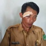 Tragis, Guru SMP di Luwu Utara Babak Belur Dihajar Siswa Usai Tegur Aksi Bolos