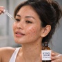 Kalau Lagi Jerawatan, Apakah Boleh Pakai Retinol? Begini Tips Amannya