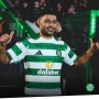 Sempat Latihan Bersama Arsenal, Alex Oxlade-Chamberlain Resmi Gabung Celtic