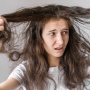 Tips Mengatasi Rambut Pitak Menurut Dokter Incognito, Hindari Kebiasaan Ini!