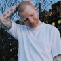 Sambut Awal Baru, Ed Sheeran Tampil dengan Kepala Botak usai Idap Herpes Zoster
