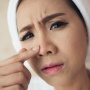 5 Cleansing Balm Lokal Ampuh Hempas Komedo, Wajah Jadi Bersih Seketika!