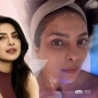 XERF Jadi Treatment Pilihan Priyanka Chopra Jonas, Kulit Kencang Natural Tanpa Operasi
