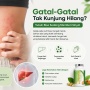 Gatal-Gatal Tak Kunjung Sembuh? Bisa Jadi Tanda Gangguan Liver yang Sering Diabaikan