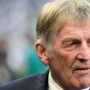 Legenda Liverpool Kenny Dalglish Jalani Perawatan Kanker
