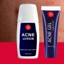 Beda Acne Lotion dan Acne Gel Viva, Kenali Fungsi serta Cara Pakainya sebelum Beli