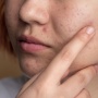 4 Serum Salicylic Acid Mengandung Centella Asiatica untuk Jerawat dan Bruntusan