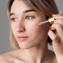 5 Serum yang Ampuh Hempas Bruntusan Sesuai Review Pembeli, Tekstur Kulit Jadi Lebih Halus