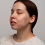 Cushion vs Foundation: Mana yang Lebih Aman dan Ampuh untuk Kulit Berjerawat?
