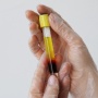 Ekosistem Produk Obat Derivat Plasma Mulai Dibangun, Indonesia Siapkan Jaringan Bank Plasma