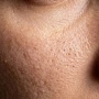 Serum Apa yang Bagus untuk Mengecilkan Pori-Pori? Ini 4 Pilihan Sesuai Review