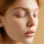 Sering Dianggap Sama, Ini 5 Perbedaan Freckles Alami vs Sunspots Flek Penuaan