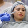 Inovasi Terbaru Kecantikan Wajah, Volulift 2.0 Resmi Diperkenalkan
