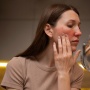 Tak Sama, Ketahui Ciri-Ciri Rosacea serta Bedanya dengan Jerawat Biasa