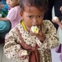 Balita di Tegal Angus Diperiksa Dokter Spesialis, Pulang Bawa Telur dan Susu