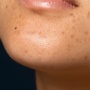 6 Serum Tranexamic Acid untuk Melasma dan PIH, Mulai Rp34 Ribuan