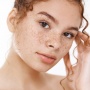 Cara Mencegah Bintik Freckles Bertambah Banyak dan Makin Gelap, Sunscreen Berperan Penting