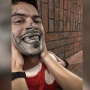 Kondisi Korban Serangan Brutal Eks Timnas Indonesia Jhon van Beukering: Tujuh Gigi Copot