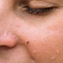 Cara Membedakan Keringat Biasa vs Sunscreen Luntur Saat Cuaca Panas Terik, Cek Tandanya