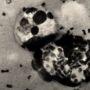 Apa Itu Bakteri Yersinia Pestis? Diduga Bocor di Lab RUsia, Sumber dari Wabah Black Death