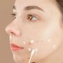 4 Acne Spot Sulfur Solusi Buat Jerawat Auto Cepat Kering dan Kontrol Minyak