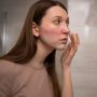 7 Cara Mengatasi Kulit Perih dan Memerah saat Mencoba Krim Retinol agar Iritasi Mereda