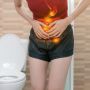 Saat Perlengketan Usus Melibatkan Saluran Kemih, Mengapa Penanganannya Lebih Kompleks?
