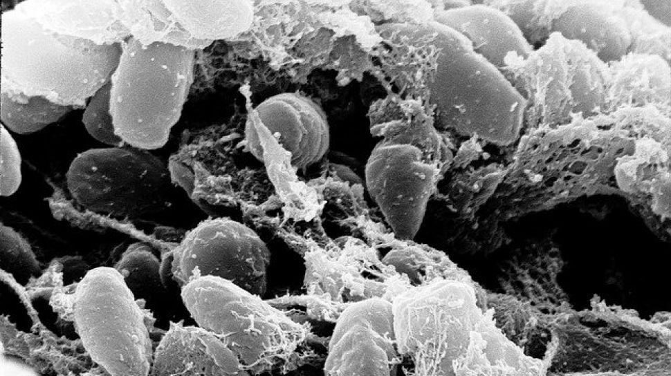 Ketahui Fakta Bubonic Plague Penyakit Yang Dijuluki Kematian