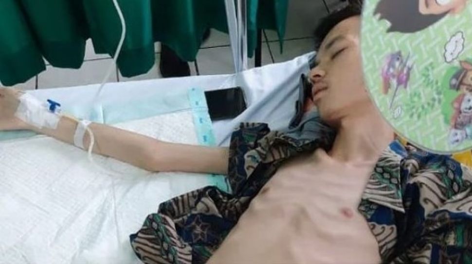 Mahasiswa Unand Ilhamdiza Butuh Bantuan Usus Bocor Badan Tinggal Tulang Suara Bali