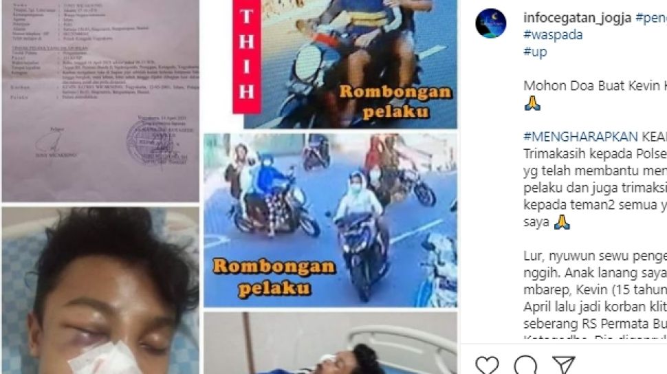 Jadi Korban Klitih, Kevin Dihantam Batu Usai Pulang Subuhan - Suara Jogja