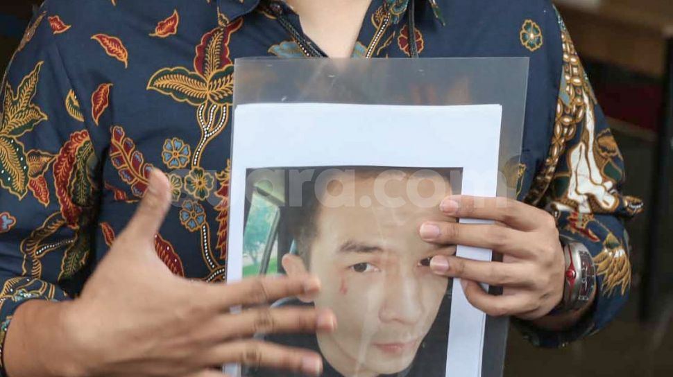 Diperiksa Polisi Jonathan Frizzy Bawa Foto Wajahnya Dengan Luka Cakar