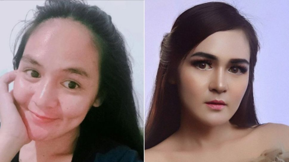 10 Potret Terbaru Chaca Mantan Istri Andika Kangen Band Setelah Rehabilitasi Makin Glowing 