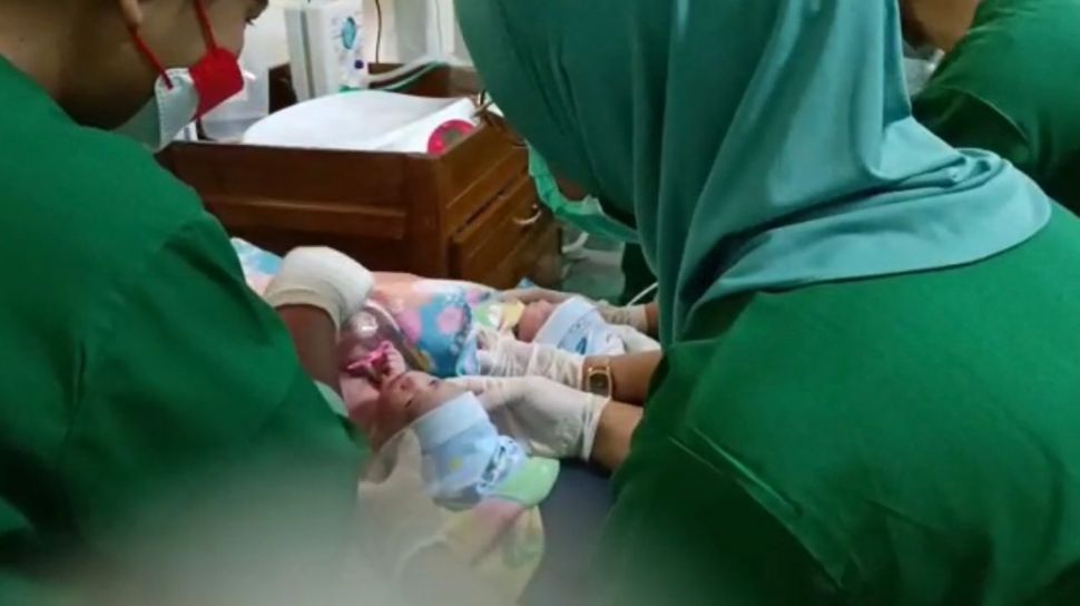 Bayi Kembar Tiga Berhasil Lahir di Belitung, Begini Cerita Haru di Balik Proses Persalinannya