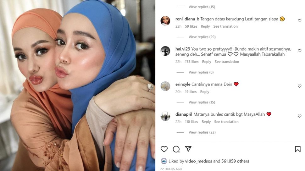 Foto Bareng Lesti Kejora Tangan Dinda Hauw Jadi Omongan Warganet 9389